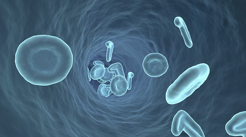 動脈硬化を改善するために