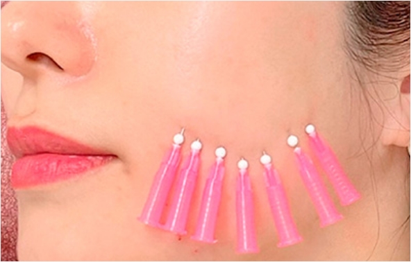 リードファインリフト